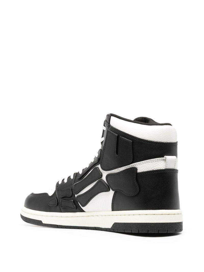 Black Skel High-top Leather Sneakers