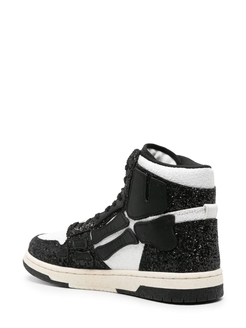 Black Skel High-top Sneakers