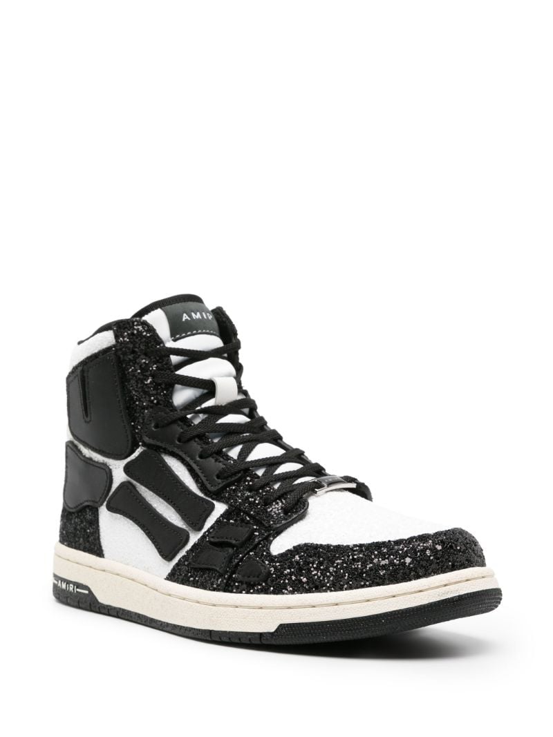Black Skel High-top Sneakers