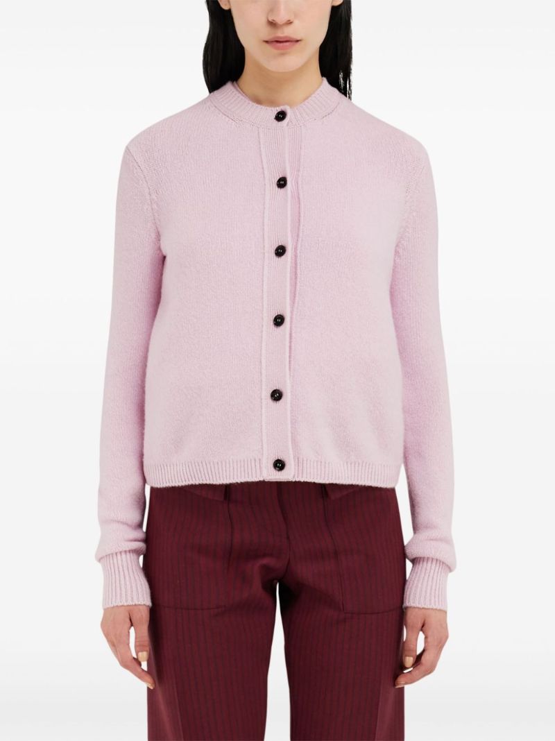 Button-up Cardigan